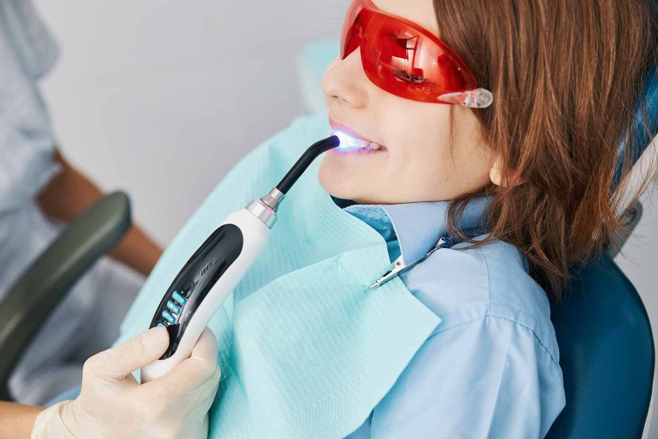 Dental curing light setting composite resins in kid teeth